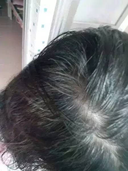 白發(fā)變黑發(fā)最快土法——自然黑發(fā)秘訣大揭秘，自然黑發(fā)秘訣，白發(fā)轉(zhuǎn)黑發(fā)最快土法大揭秘