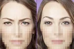 額頭千萬不能打除皺針，了解風(fēng)險與后果，做出明智選擇，額頭除皺針的風(fēng)險與后果，明智選擇需了解的內(nèi)容