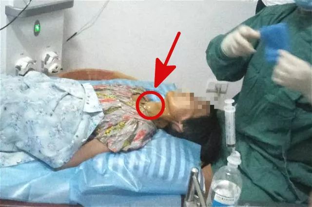 甲狀腺結(jié)節(jié)4A持續(xù)二十年，深入了解與管理，甲狀腺結(jié)節(jié)二十年持續(xù)觀察與管理策略