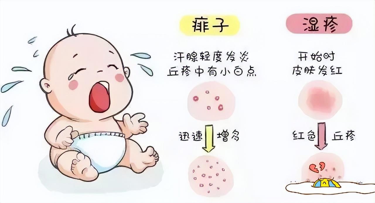 痱子和濕疹的區(qū)別，深入了解兩種常見皮膚狀況，痱子和濕疹的區(qū)別，常見皮膚狀況詳解