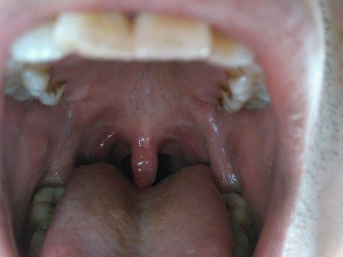 嗓子感覺(jué)糊了一層粘液，原因、緩解與預(yù)防策略，嗓子糊粘液，成因、緩解及預(yù)防策略