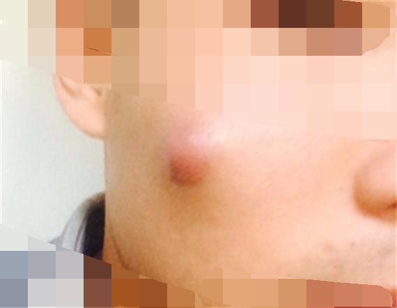 臉上一摸全是小顆粒，原因解析與應(yīng)對方法，臉部小顆粒密布，原因解析及應(yīng)對方法