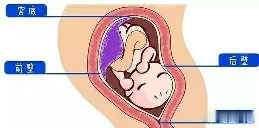 前壁和后壁順產(chǎn)疼痛對(duì)比，深度解析產(chǎn)程疼痛感受，前壁與后壁順產(chǎn)疼痛對(duì)比，深度探討產(chǎn)程疼痛感受的差異性