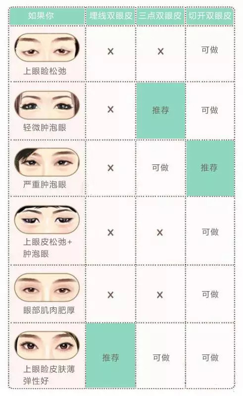 如何養(yǎng)出雙眼皮——全方位指南，全方位指南，如何養(yǎng)出雙眼皮