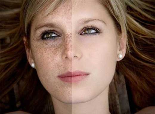 去除臉上的斑小妙招，實(shí)用方法與日常護(hù)理建議，實(shí)用小妙招，祛斑美白，日常護(hù)理臉部斑點(diǎn)的方法