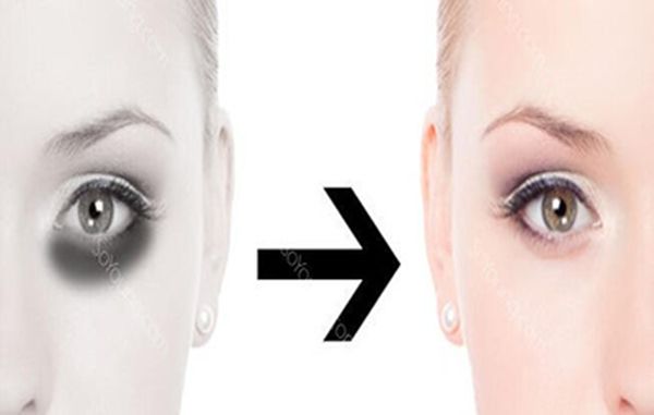 怎樣去黑眼圈最有效最快？全面解析黑眼圈消除方法，全面解析，快速有效消除黑眼圈的方法與技巧