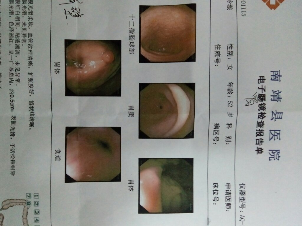 如何判斷自己是否患有胃炎——癥狀、檢查與預(yù)防，如何判斷自己是否患有胃炎，癥狀、檢查、預(yù)防全解析