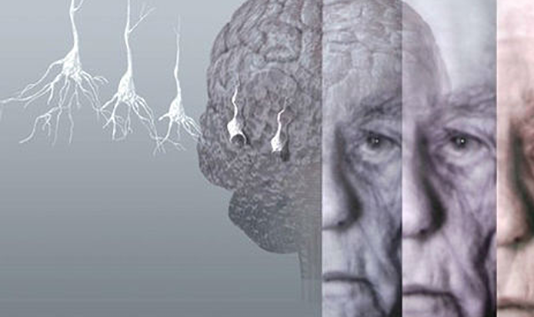 阿爾茲海默癥，了解、預(yù)防與關(guān)懷，阿爾茲海默癥，了解、預(yù)防與患者的關(guān)懷之路